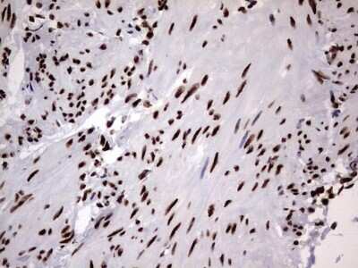 Immunohistochemistry: hnRNP M Antibody (OTI4C9) [NBP2-45991]