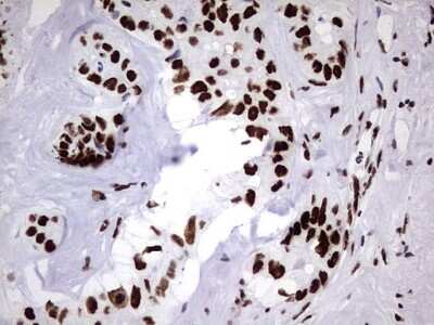 Immunohistochemistry: hnRNP M Antibody (OTI4C9) [NBP2-45991]