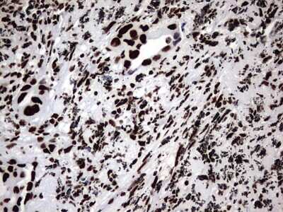 Immunohistochemistry: hnRNP M Antibody (OTI4C9) [NBP2-45991]