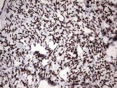 Immunohistochemistry: hnRNP M Antibody (OTI4C9) [NBP2-45991]