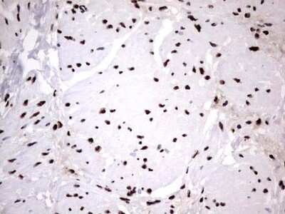 Immunohistochemistry: hnRNP M Antibody (OTI4C9) [NBP2-45991]