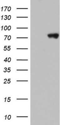 Western Blot: hnRNP M Antibody (OTI4C9) [NBP2-45991]