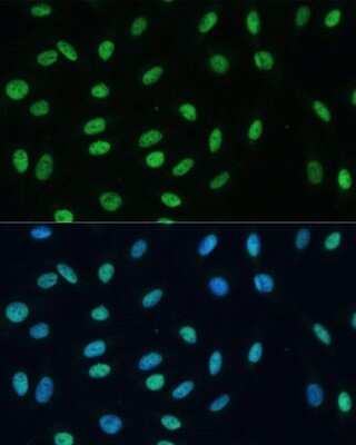 Immunocytochemistry/ Immunofluorescence: hnRNP M Antibody - Azide and BSA Free [NBP3-03746]