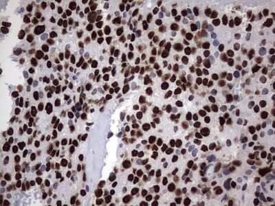 Immunohistochemistry: hnRNP M Antibody (OTI4C9) - Azide and BSA Free [NBP2-71200]