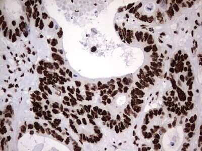 Immunohistochemistry: hnRNP M Antibody (OTI4C9) - Azide and BSA Free [NBP2-71200]