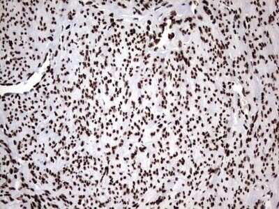 Immunohistochemistry: hnRNP M Antibody (OTI4C9) - Azide and BSA Free [NBP2-71200]