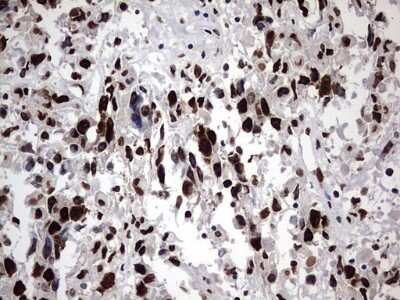 Immunohistochemistry: hnRNP M Antibody (OTI4C9) - Azide and BSA Free [NBP2-71200]