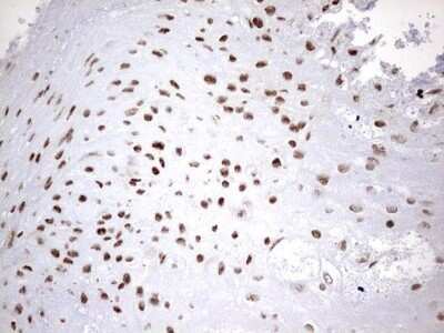 Immunohistochemistry: hnRNP M Antibody (OTI4C9) - Azide and BSA Free [NBP2-71200]