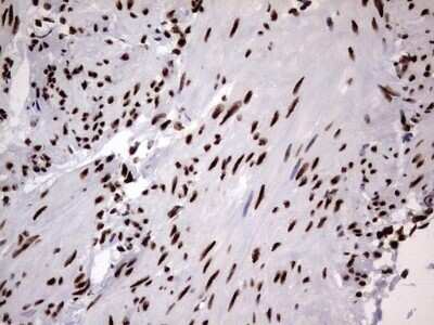 Immunohistochemistry: hnRNP M Antibody (OTI4C9) - Azide and BSA Free [NBP2-71200]