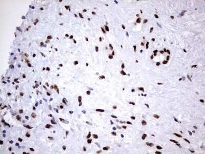 Immunohistochemistry: hnRNP M Antibody (OTI4C9) - Azide and BSA Free [NBP2-71200]