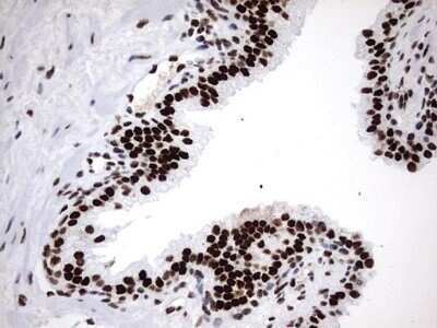 Immunohistochemistry: hnRNP M Antibody (OTI4C9) - Azide and BSA Free [NBP2-71200]