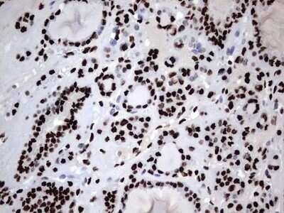 Immunohistochemistry: hnRNP M Antibody (OTI4C9) - Azide and BSA Free [NBP2-71200]