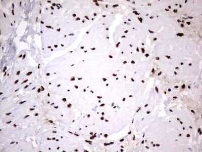 Immunohistochemistry: hnRNP M Antibody (OTI4C9) - Azide and BSA Free [NBP2-71200]