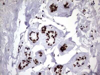 Immunohistochemistry: hnRNP M Antibody (OTI4C9) - Azide and BSA Free [NBP2-71200]