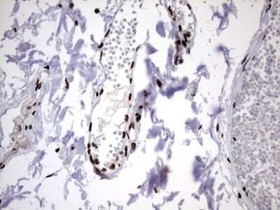 Immunohistochemistry: hnRNP M Antibody (OTI4C9) - Azide and BSA Free [NBP2-71200]