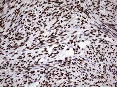 Immunohistochemistry: hnRNP M Antibody (OTI4C9) - Azide and BSA Free [NBP2-71200]