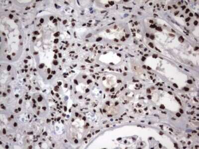Immunohistochemistry: hnRNP M Antibody (OTI4C9) - Azide and BSA Free [NBP2-71200]