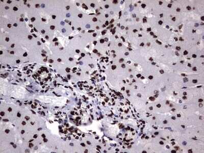 Immunohistochemistry: hnRNP M Antibody (OTI4C9) - Azide and BSA Free [NBP2-71200]