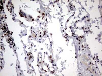 Immunohistochemistry: hnRNP M Antibody (OTI4C9) - Azide and BSA Free [NBP2-71200]