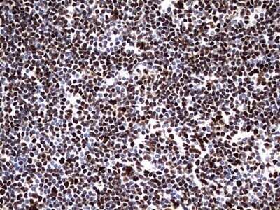 Immunohistochemistry: hnRNP M Antibody (OTI4C9) - Azide and BSA Free [NBP2-71200]