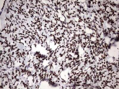 Immunohistochemistry: hnRNP M Antibody (OTI4C9) - Azide and BSA Free [NBP2-71200]