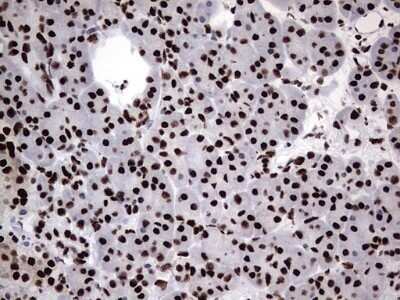 Immunohistochemistry: hnRNP M Antibody (OTI4C9) - Azide and BSA Free [NBP2-71200]