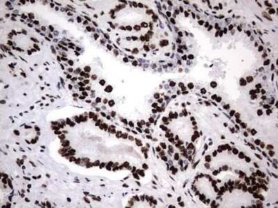 Immunohistochemistry: hnRNP M Antibody (OTI4C9) - Azide and BSA Free [NBP2-71200]
