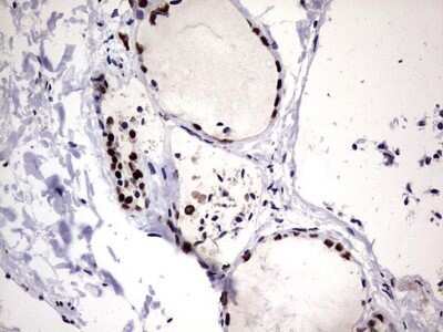 Immunohistochemistry: hnRNP M Antibody (OTI4C9) - Azide and BSA Free [NBP2-71200]