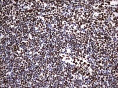 Immunohistochemistry: hnRNP M Antibody (OTI4C9) - Azide and BSA Free [NBP2-71200]