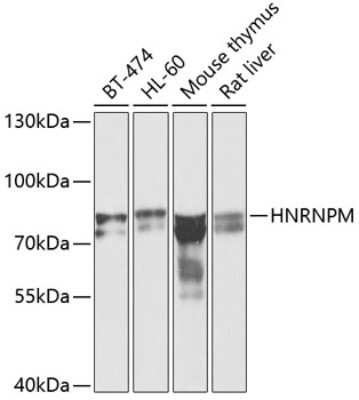 Western Blot: hnRNP M AntibodyAzide and BSA Free [NBP3-03746]