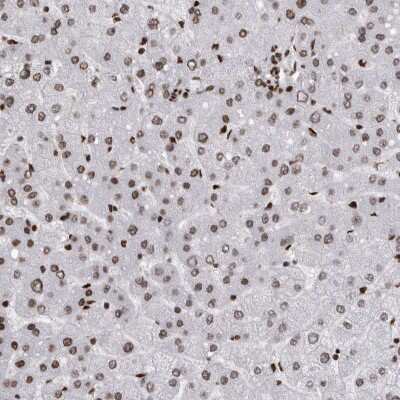 Immunohistochemistry-Paraffin: hnRNP M1-M4 Antibody [NBP1-84555]
