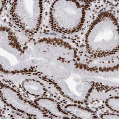 Immunohistochemistry-Paraffin: hnRNP M1-M4 Antibody [NBP1-84555]