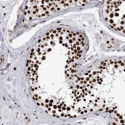 Immunohistochemistry-Paraffin: hnRNP M1-M4 Antibody [NBP1-84555]