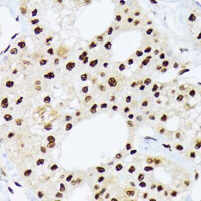 Immunohistochemistry-Paraffin: hnRNP-Q Antibody (1R0G5) [NBP3-16838]