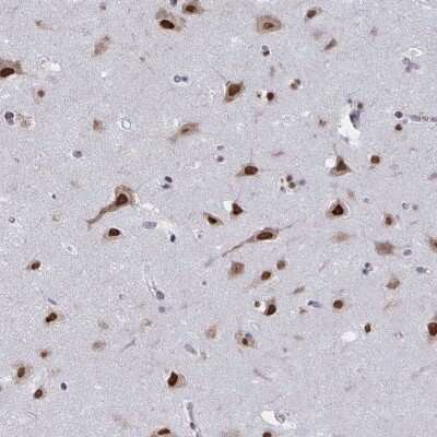 Immunohistochemistry-Paraffin: hnRNP-Q Antibody [NBP2-34068]