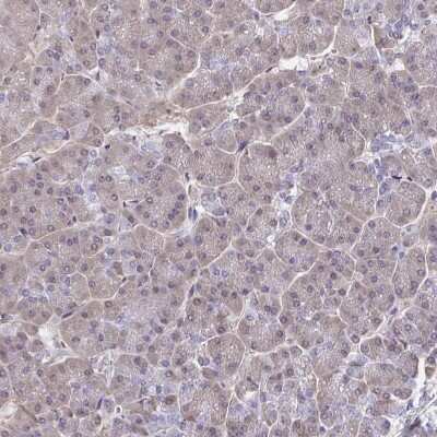 Immunohistochemistry-Paraffin: hnRNP-Q Antibody [NBP2-34068]