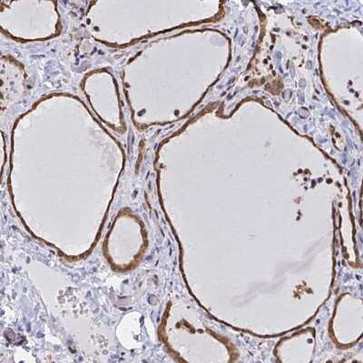 Immunohistochemistry-Paraffin: hnRNP-Q Antibody [NBP2-34068]