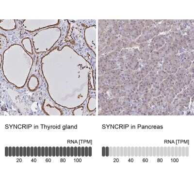 Immunohistochemistry-Paraffin: hnRNP-Q Antibody [NBP2-34068]