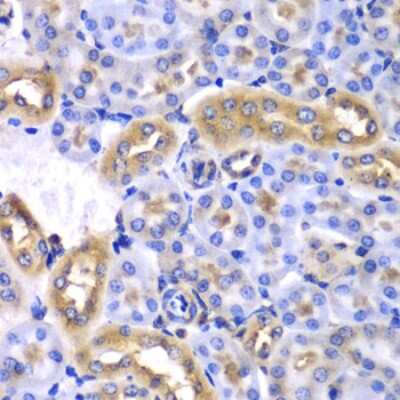 Immunohistochemistry-Paraffin: hnRNP-Q Antibody - BSA Free [NBP3-03335]