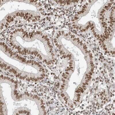 Immunohistochemistry-Paraffin: hnRNP-R Antibody [NBP1-89676]