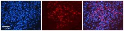 Immunohistochemistry: hnRNP U Antibody [NBP1-57146]