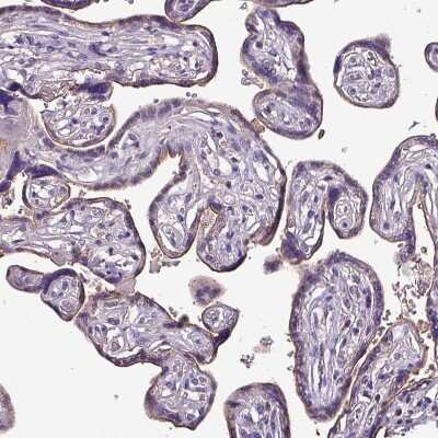 Immunohistochemistry-Paraffin: htrA4 Antibody [NBP2-30882]