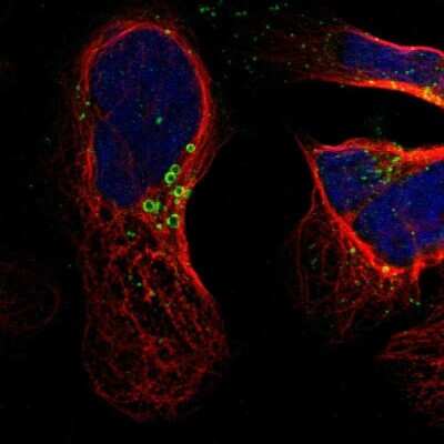 Immunocytochemistry/ Immunofluorescence: hydroxysteroid (17-beta) dehydrogenase 11 Antibody [NBP1-90334]