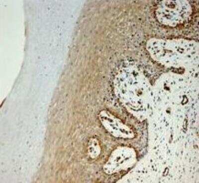 Immunohistochemistry-Paraffin: hydroxysteroid (17-beta) dehydrogenase 11 Antibody [NBP1-57081]