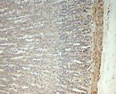 Immunohistochemistry-Paraffin: hydroxysteroid (17-beta) dehydrogenase 11 Antibody [NBP1-57081]