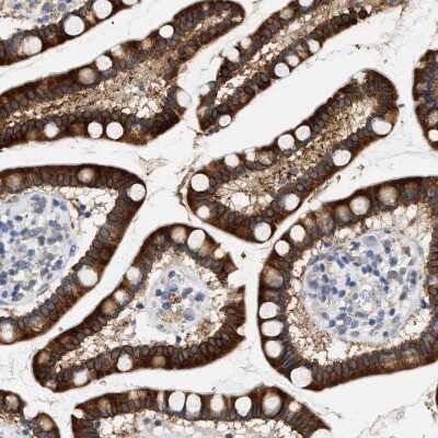Immunohistochemistry-Paraffin: hydroxysteroid (17-beta) dehydrogenase 11 Antibody [NBP1-90334]