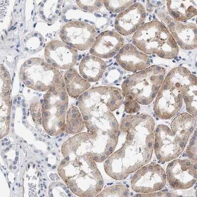 Immunohistochemistry-Paraffin: hydroxysteroid (17-beta) dehydrogenase 11 Antibody [NBP1-90334]