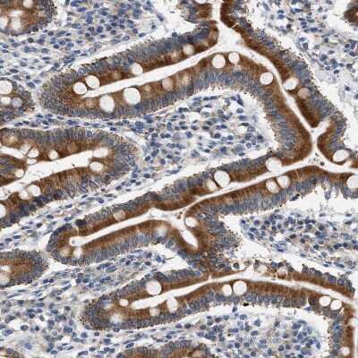 Immunohistochemistry-Paraffin: hydroxysteroid (17-beta) dehydrogenase 11 Antibody [NBP1-90334]