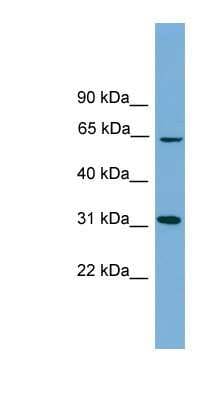 Western Blot: hydroxysteroid (17-beta) dehydrogenase 11 Antibody [NBP1-57081]