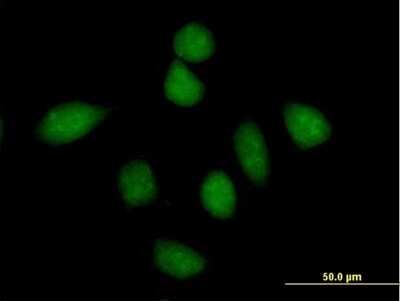 Immunocytochemistry/ Immunofluorescence: iASPP Antibody [H00010848-B01P]